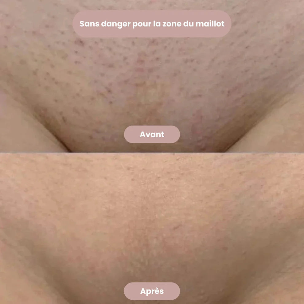 Rasoir 2 en 1 Léa Skin lea-skin.com